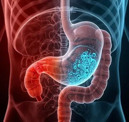 Ilustrasi Air Alkali Menetralkan Asam Lambung Secara Cepat Untuk Kesehatan